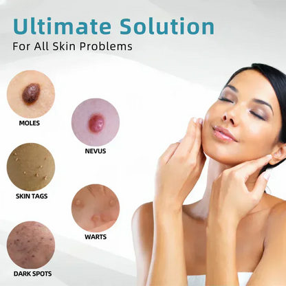 Yagoo™Canada latest All-in-One CO₂ Laser Eraser Pen | Removes Moles, Warts, Skin Flaws & Pigmentation