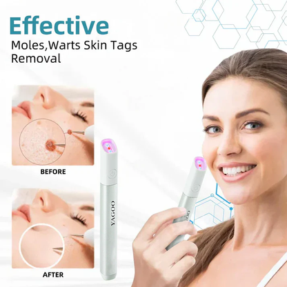Yagoo™Canada latest All-in-One CO₂ Laser Eraser Pen | Removes Moles, Warts, Skin Flaws & Pigmentation