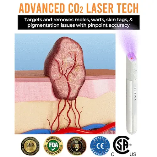 Yagoo™Canada latest All-in-One CO₂ Laser Eraser Pen | Removes Moles, Warts, Skin Flaws & Pigmentation