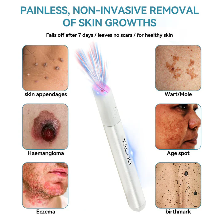 Yagoo™Canada latest All-in-One CO₂ Laser Eraser Pen | Removes Moles, Warts, Skin Flaws & Pigmentation