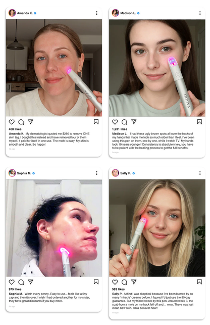 Yagoo™Canada latest All-in-One CO₂ Laser Eraser Pen | Removes Moles, Warts, Skin Flaws & Pigmentation