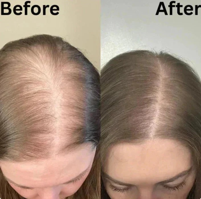 【Limited-time flash sale】Tiworld® Rosemary Shampoo